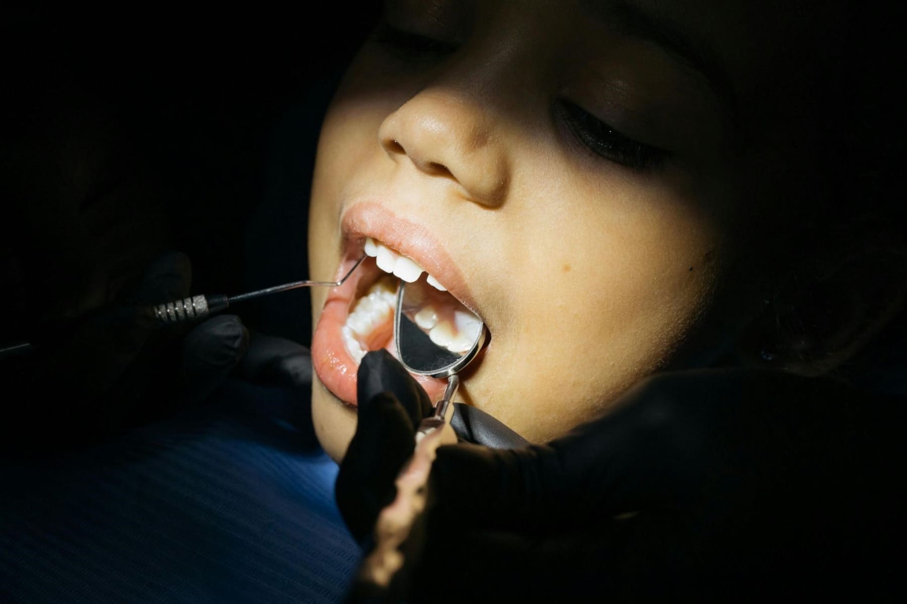 A Parent's Guide: Navigating Wobbly Teeth in Kids