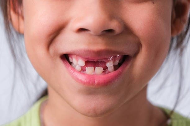 Discovering the Marvels of Baby Teeth: 10 Facts You Didn't Know
