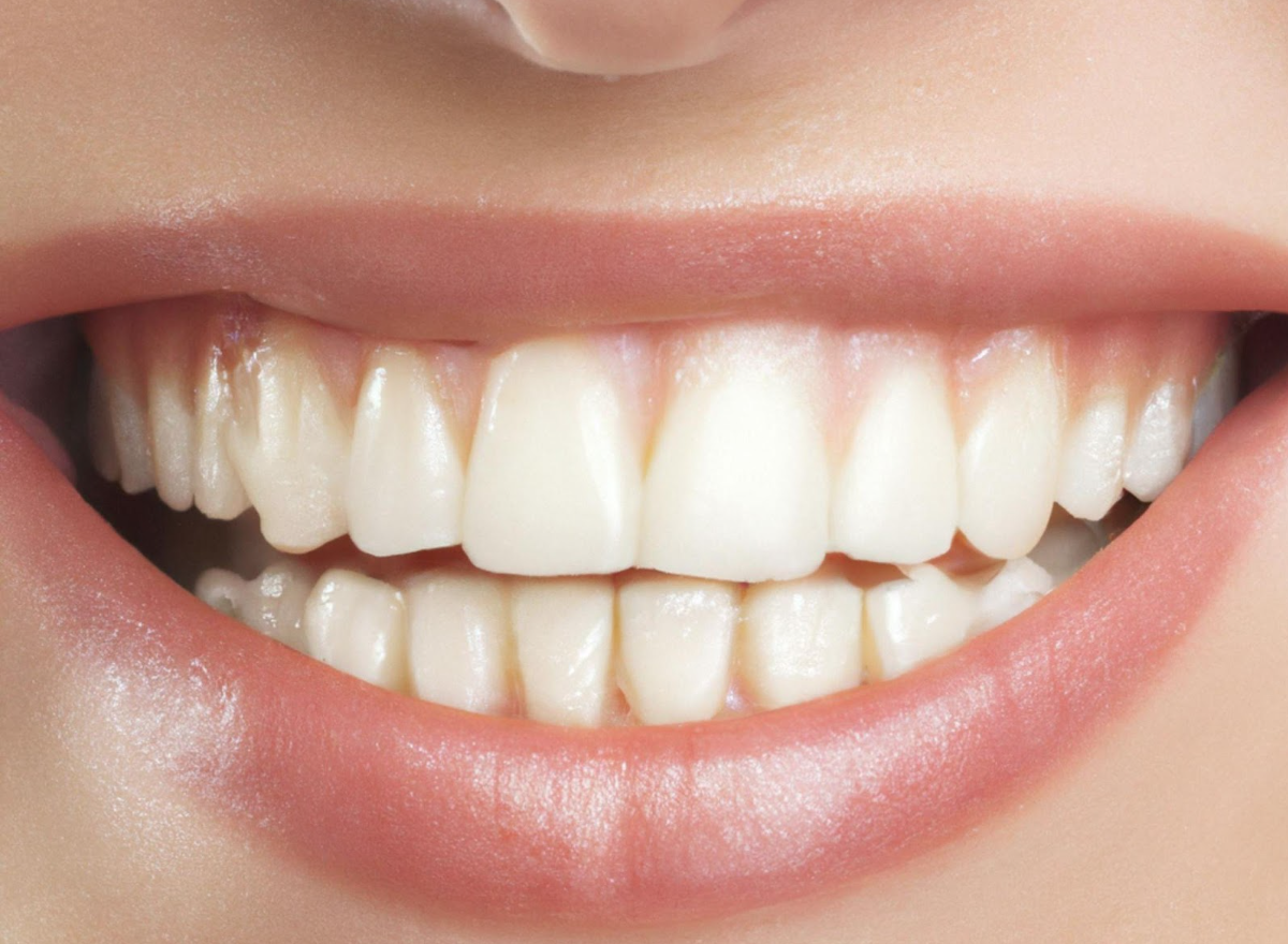 Gum Contouring: How a Cosmetic Dentist Can Improve Your Smile