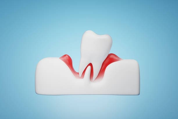 Understanding Receding Gums: Causes, Solutions, and When to Seek Help