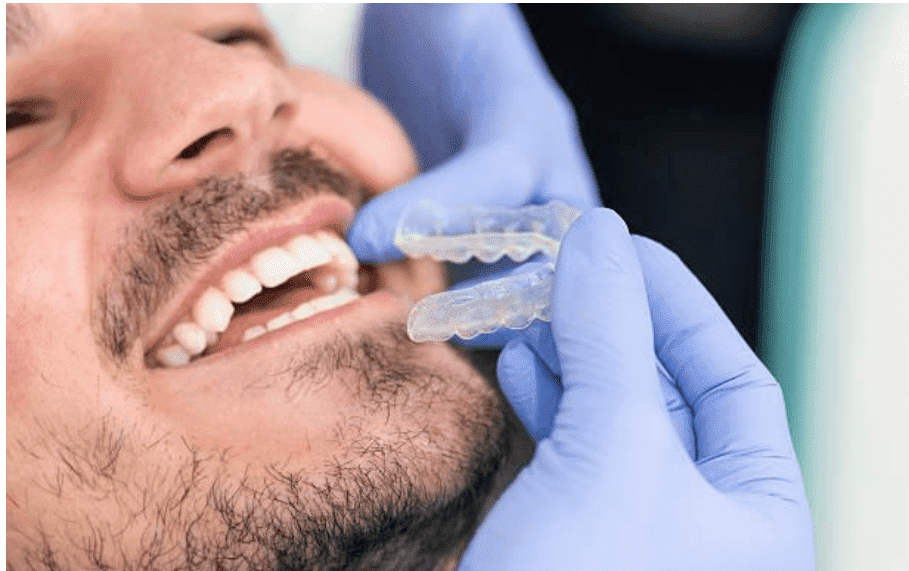 The Importance of Nightguards and Retainers in Dental Care