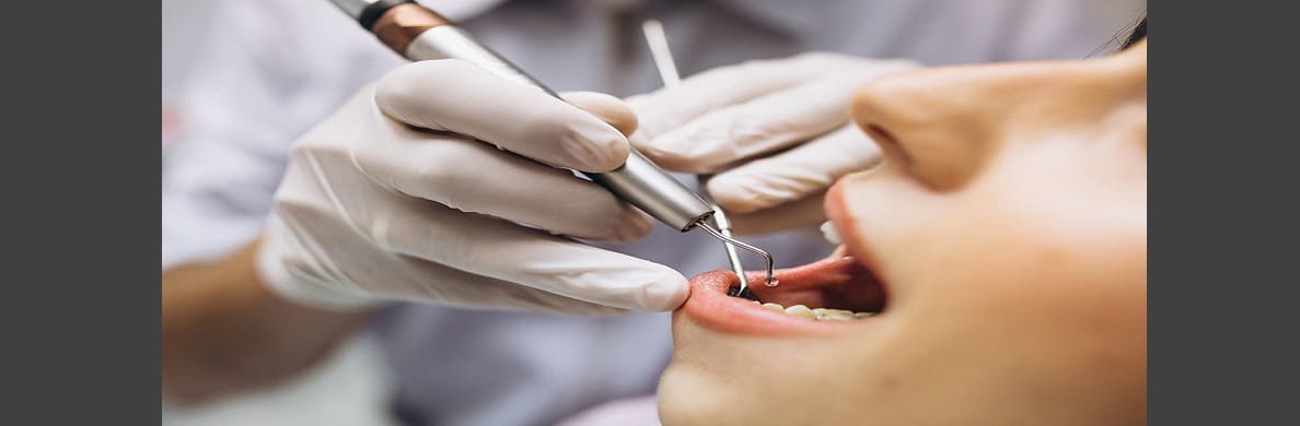 What does the healing process look like after a wisdom tooth extraction?